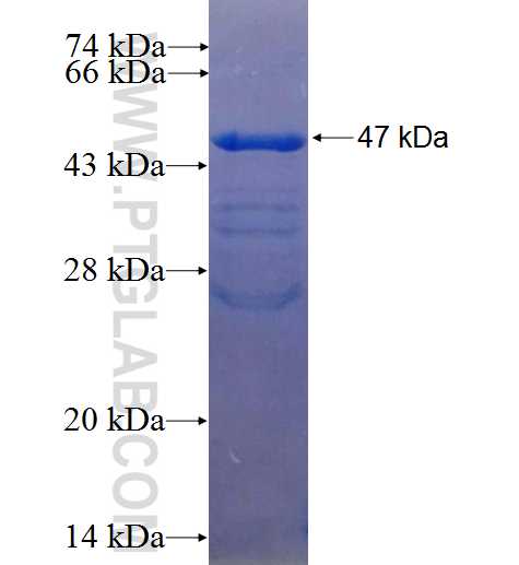 LPIN1 fusion protein Ag25815 SDS-PAGE