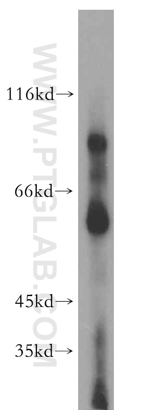 Western Blot (WB) analysis of human liver tissue using LPIN2 Polyclonal antibody (19545-1-AP)