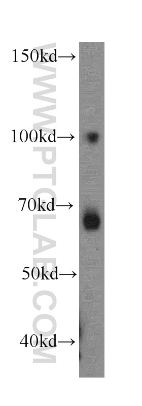 Western Blot (WB) analysis of HT-1080 cells using LPIN2 Polyclonal antibody (19545-1-AP)