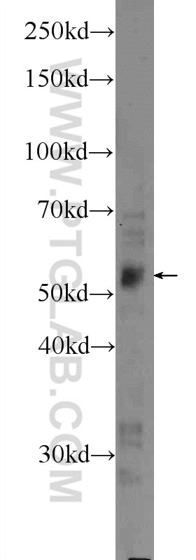 Western Blot (WB) analysis of MCF-7 cells using LPL Polyclonal antibody (16899-1-AP)