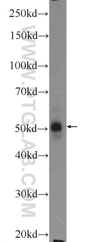 Western Blot (WB) analysis of mouse skeletal muscle tissue using LPL Polyclonal antibody (16899-1-AP)