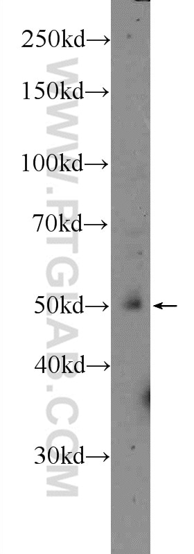 Western Blot (WB) analysis of HeLa cells using LPL Polyclonal antibody (16899-1-AP)