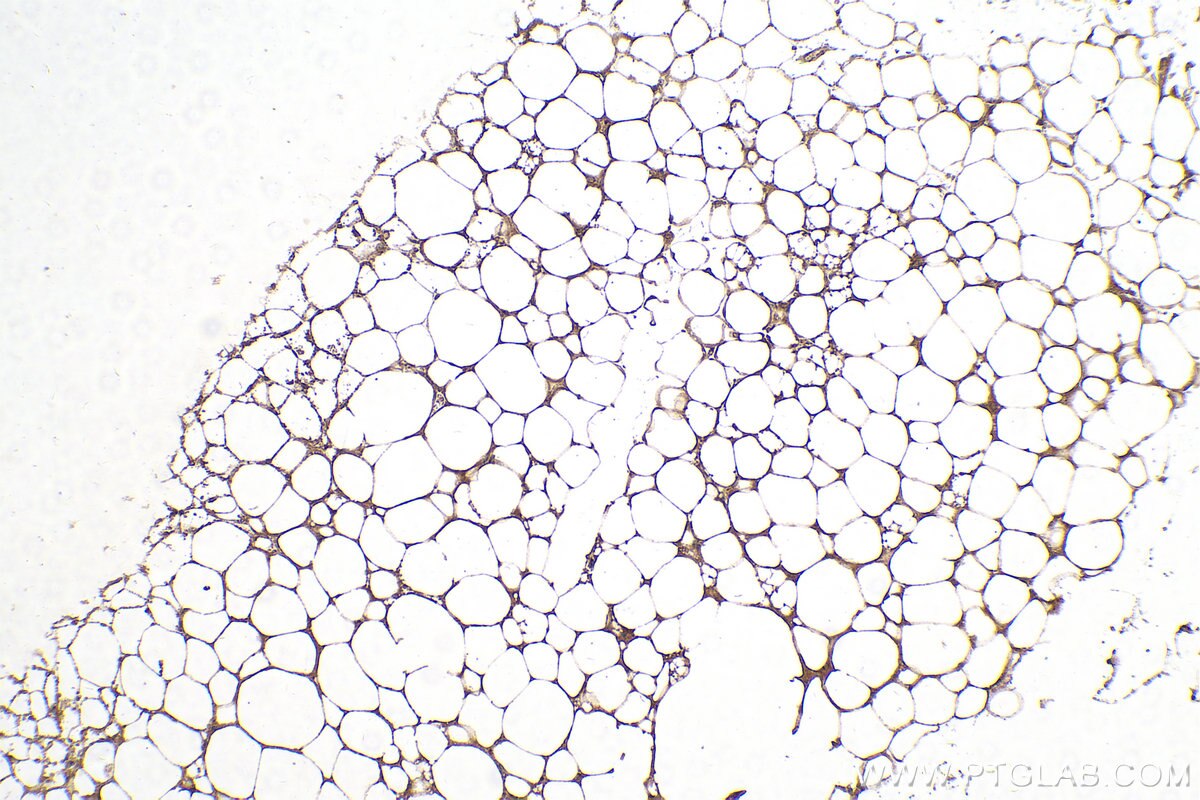Immunohistochemistry (IHC) staining of mouse brown adipose tissue using LPL Polyclonal antibody (28602-1-AP)