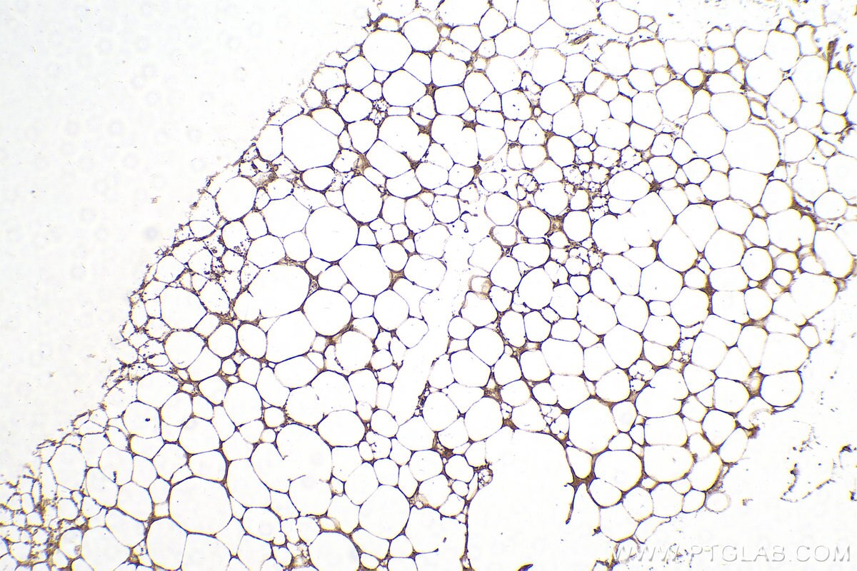 Immunohistochemistry (IHC) staining of mouse brown adipose tissue using LPL Polyclonal antibody (28602-1-AP)