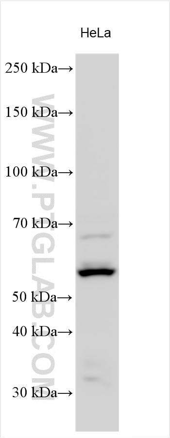 Western Blot (WB) analysis of various lysates using LPL Polyclonal antibody (28602-1-AP)