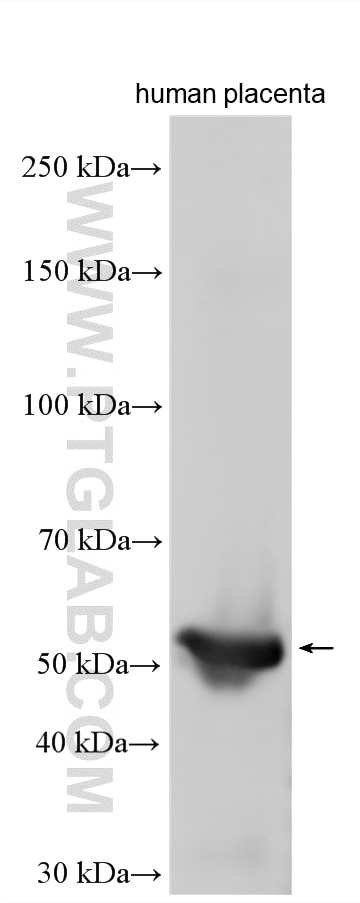 Western Blot (WB) analysis of human placenta tissue using LPL Polyclonal antibody (28602-1-AP)