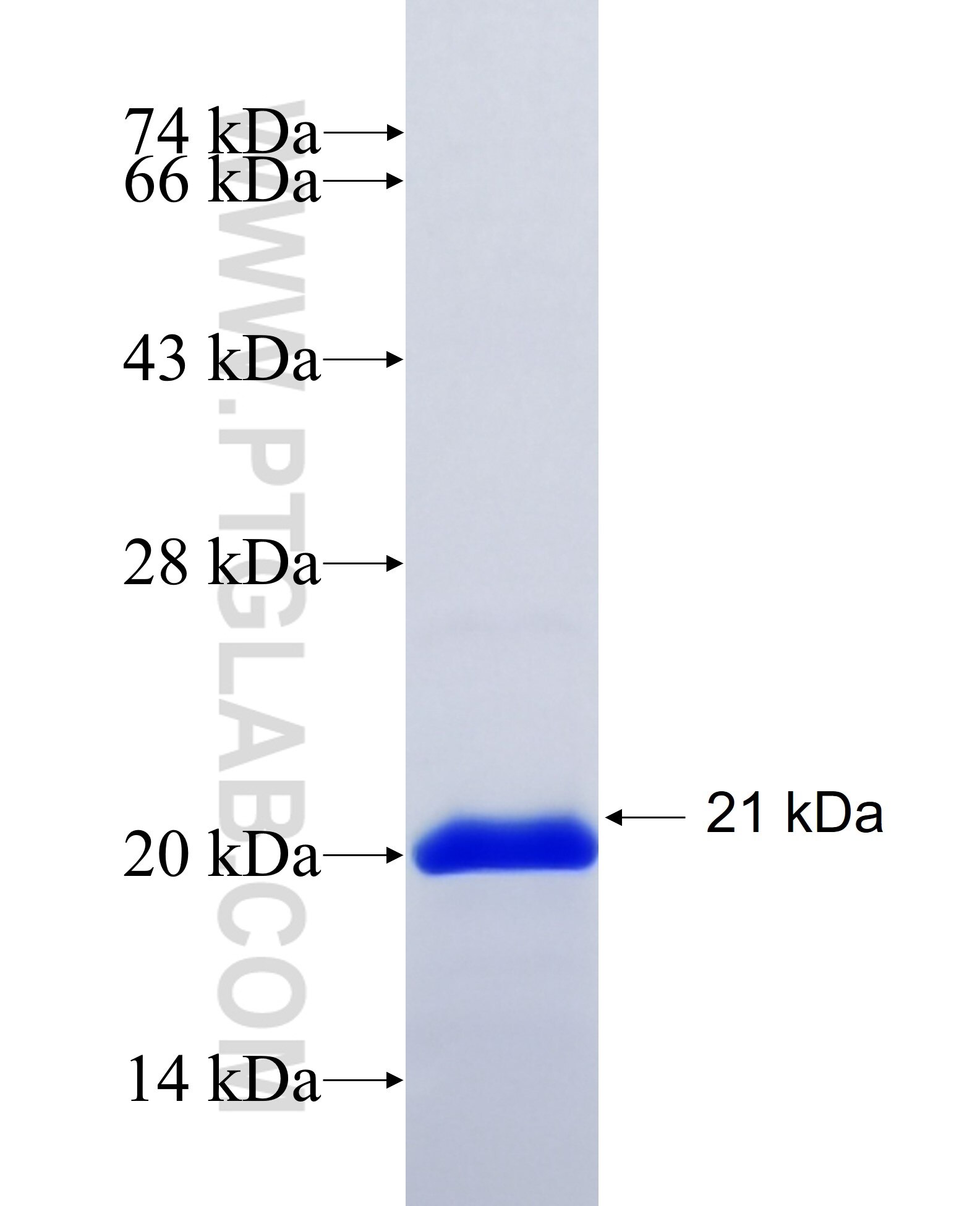 LPL fusion protein Ag29650 SDS-PAGE