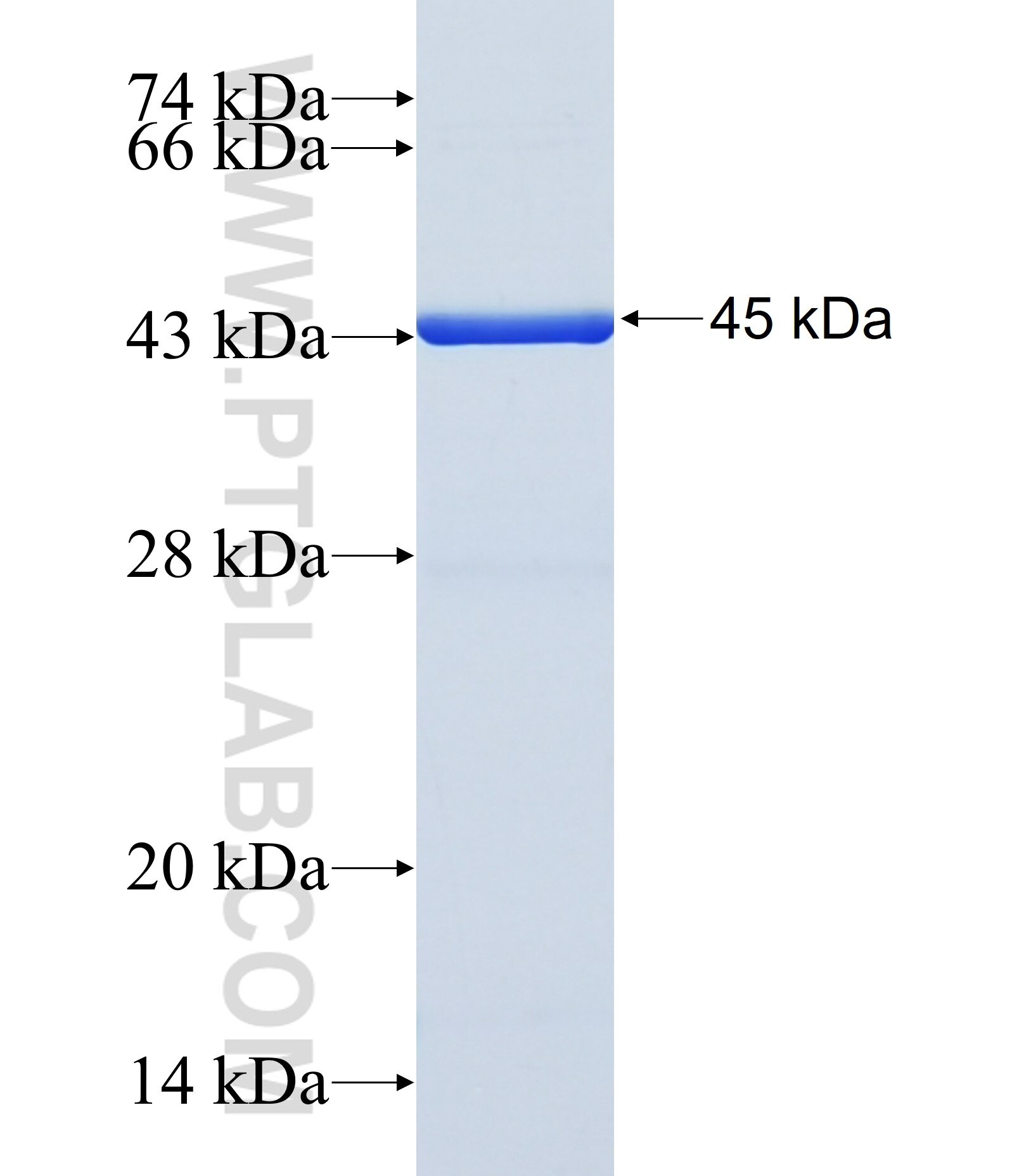 LPL fusion protein Ag29782 SDS-PAGE