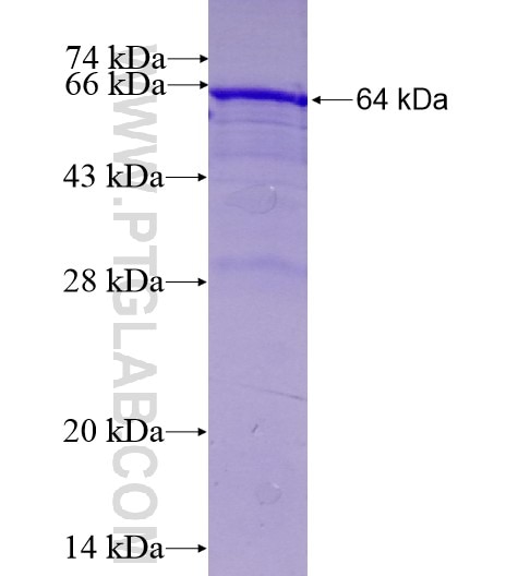 LPL fusion protein Ag10431 SDS-PAGE