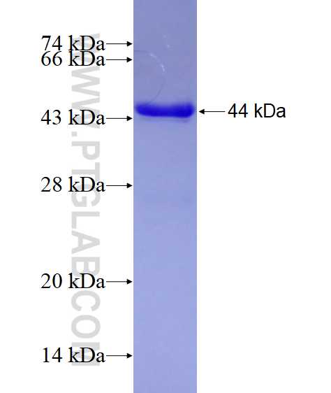 LPL fusion protein Ag10450 SDS-PAGE