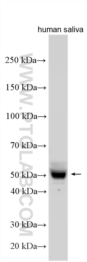 Various lysates were subjected to SDS PAGE followed by western blot with 24699-1-AP (LPLUNC1 antibody) at dilution of 1:5000 incubated at room temperature for 1.5 hours. Western Blot (WB) analysis of various lysates using LPLUNC1 Polyclonal antibody (24699-1-AP)