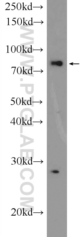 Western Blot (WB) analysis of K-562 cells using LPO Polyclonal antibody (10376-1-AP)