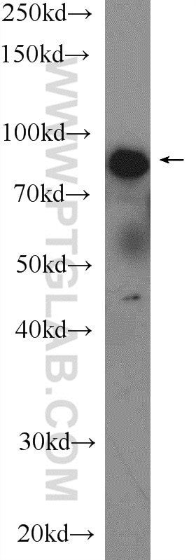 Western Blot (WB) analysis of human saliva using LPO Polyclonal antibody (10376-1-AP)