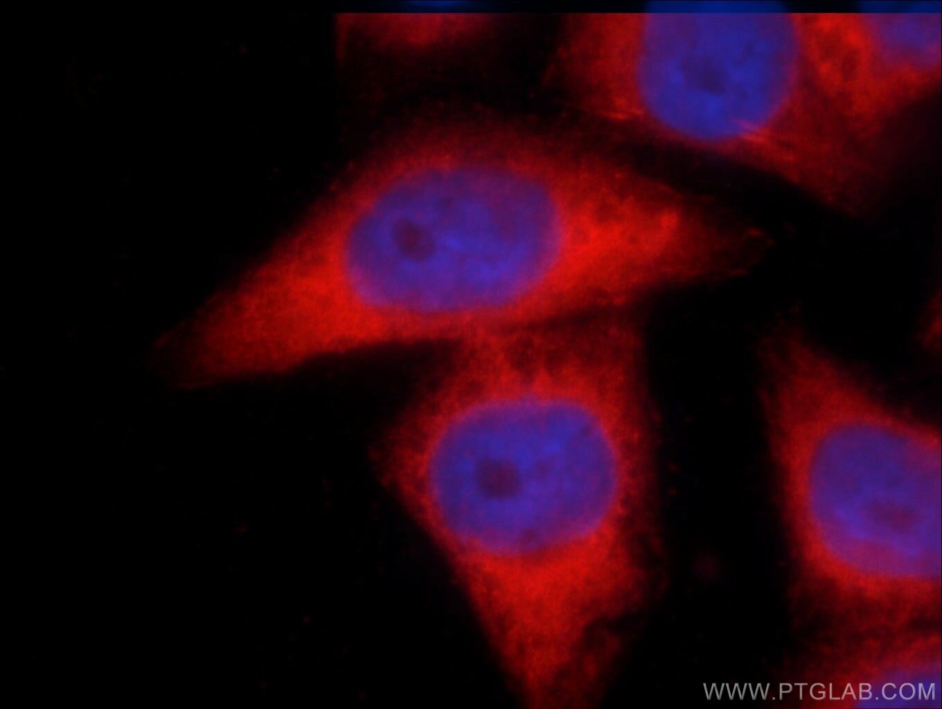 Immunofluorescence (IF) / fluorescent staining of HeLa cells using LPP Polyclonal antibody (25045-1-AP)