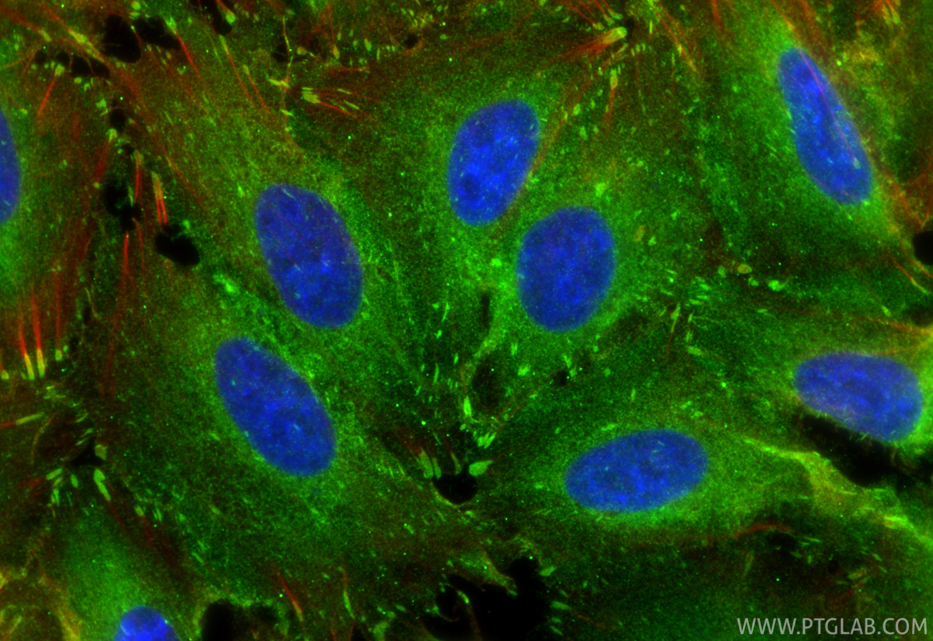 Immunofluorescence (IF) / fluorescent staining of A549 cells using LPP Polyclonal antibody (25045-1-AP)