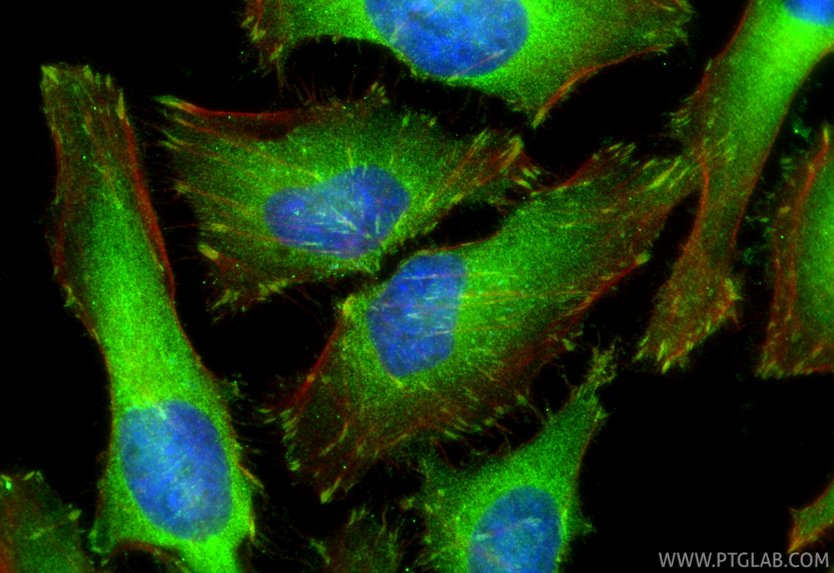 Immunofluorescence (IF) / fluorescent staining of HeLa cells using LPP Polyclonal antibody (25045-1-AP)