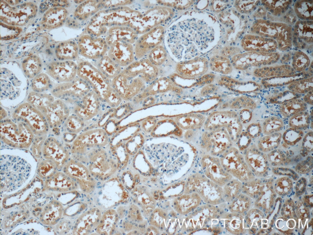 Immunohistochemistry (IHC) staining of human kidney tissue using LPP Polyclonal antibody (25045-1-AP)