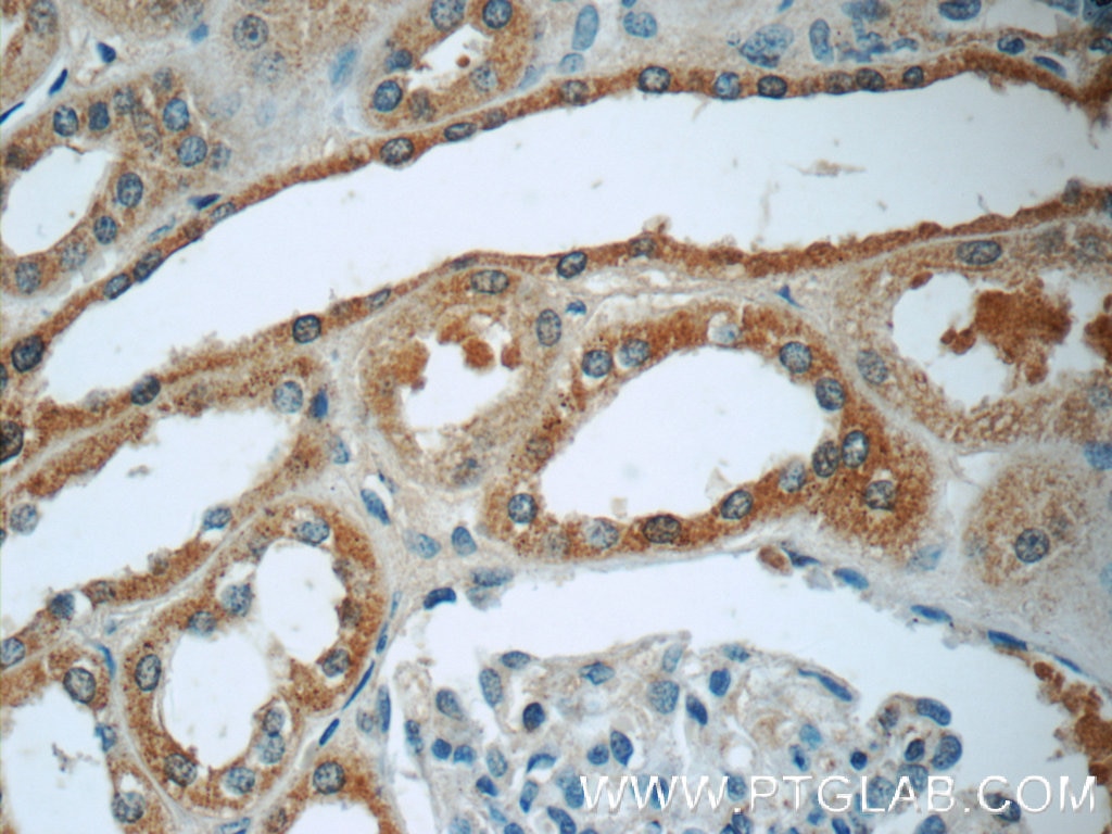 Immunohistochemistry (IHC) staining of human kidney tissue using LPP Polyclonal antibody (25045-1-AP)