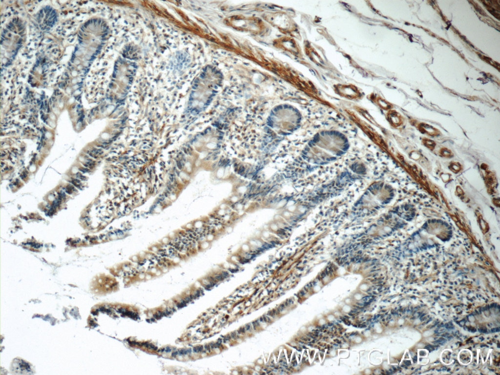 Immunohistochemistry (IHC) staining of human small intestine tissue using LPP Polyclonal antibody (25045-1-AP)