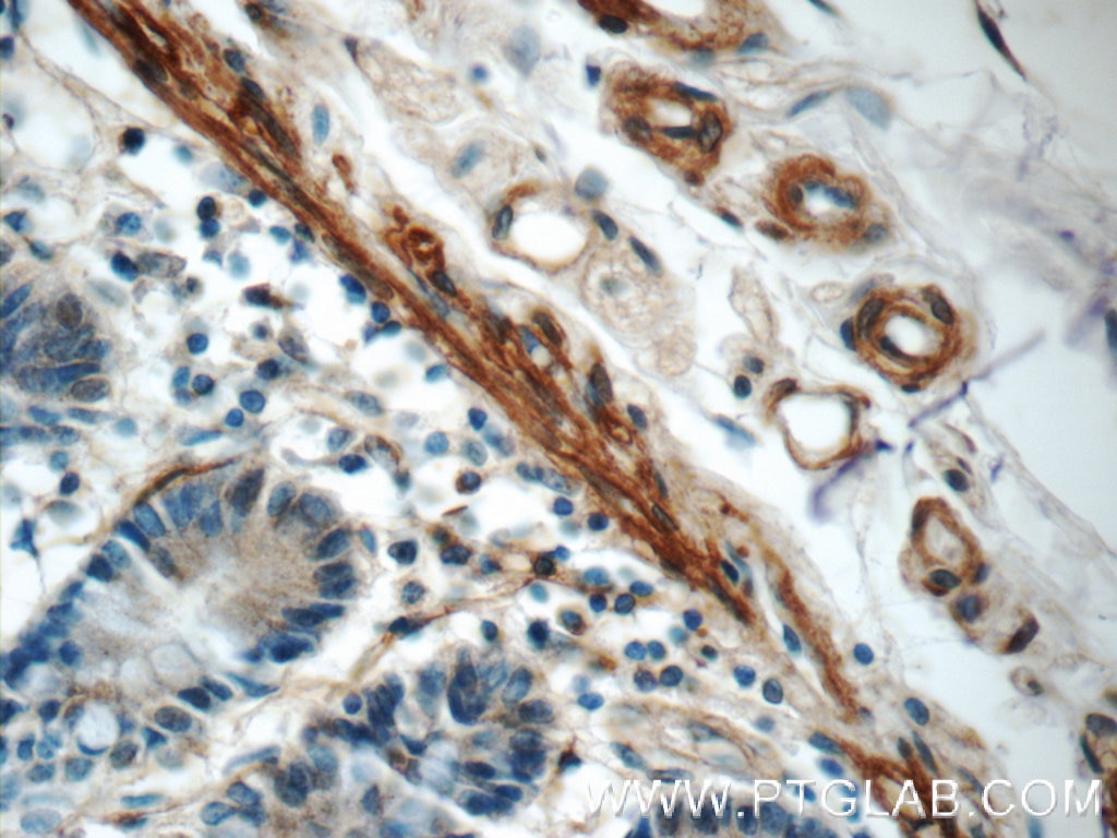 Immunohistochemistry (IHC) staining of human small intestine tissue using LPP Polyclonal antibody (25045-1-AP)