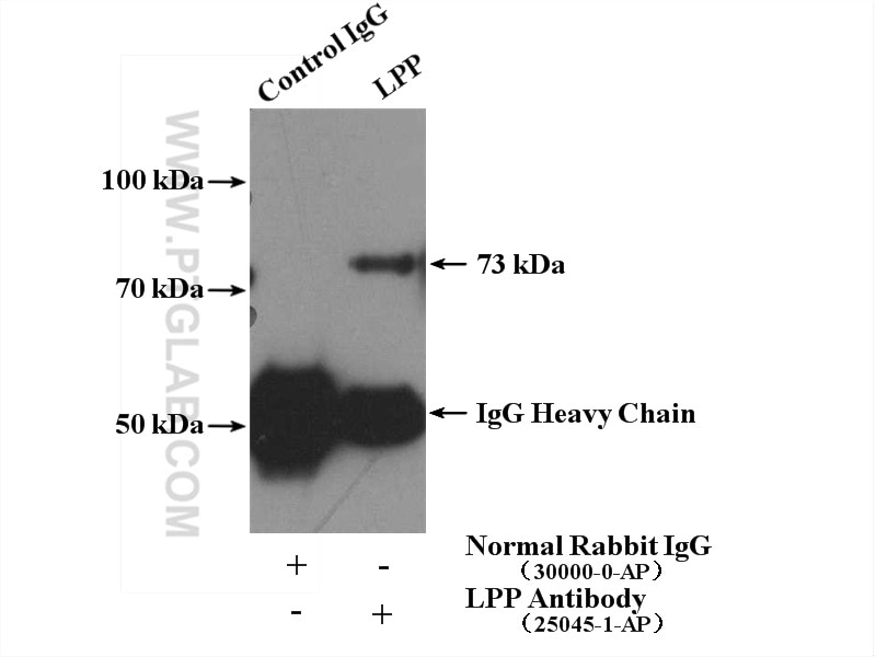 Immunoprecipitation (IP) experiment of HeLa cells using LPP Polyclonal antibody (25045-1-AP)