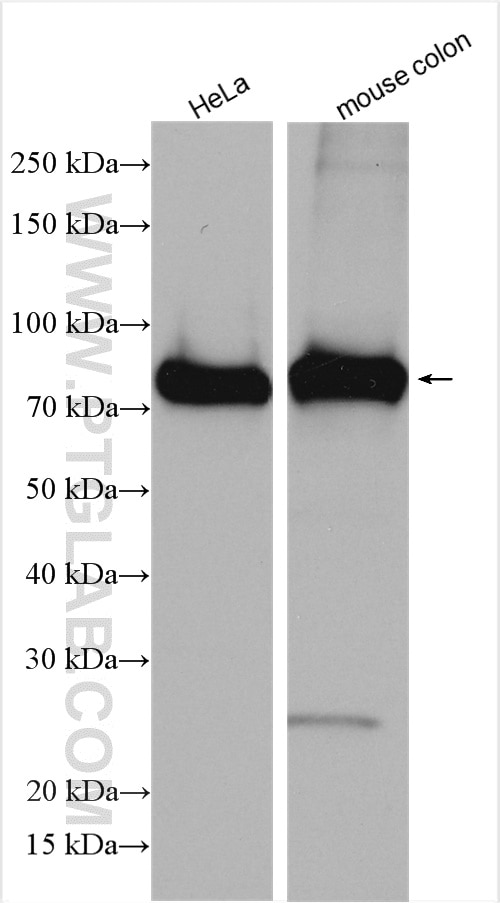 Western Blot (WB) analysis of various lysates using LPP Polyclonal antibody (25045-1-AP)