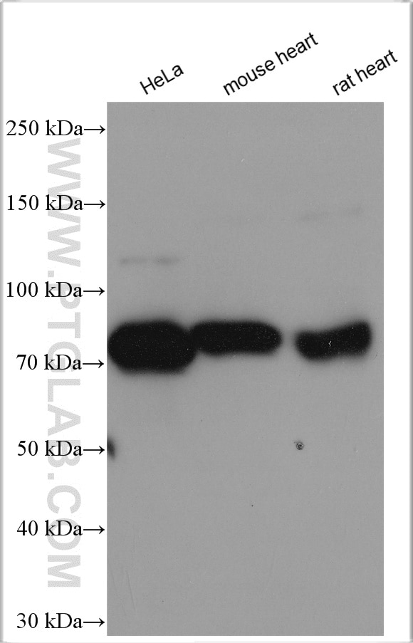 Western Blot (WB) analysis of various lysates using LPP Polyclonal antibody (25045-1-AP)