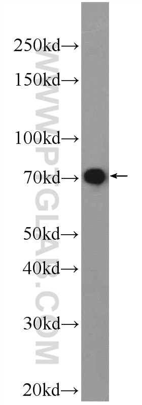 Western Blot (WB) analysis of MCF-7 cells using LPP Polyclonal antibody (25045-1-AP)