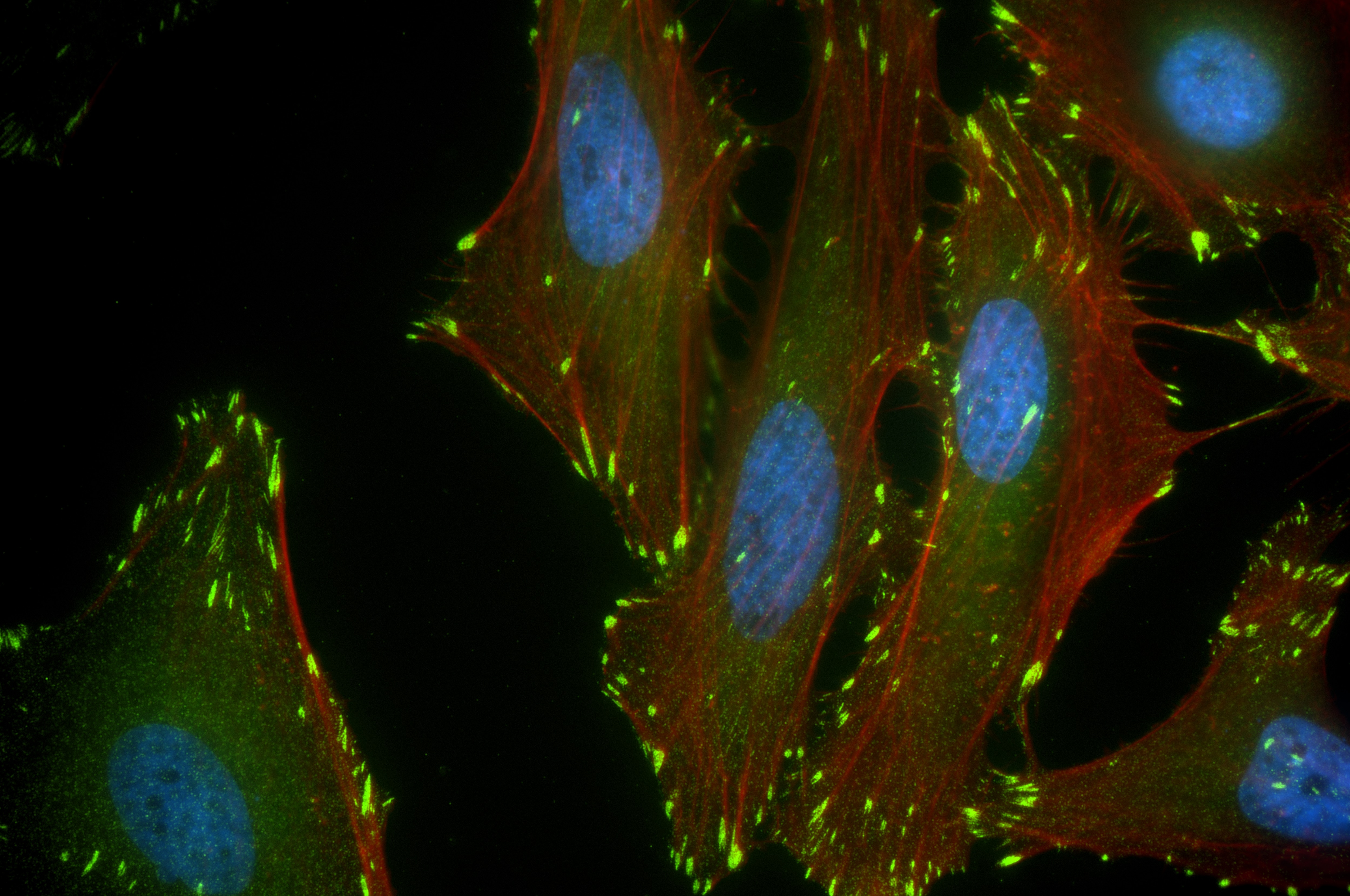 Immunofluorescence (IF) / fluorescent staining of HeLa cells using LPP Recombinant antibody (86117-3-RR)