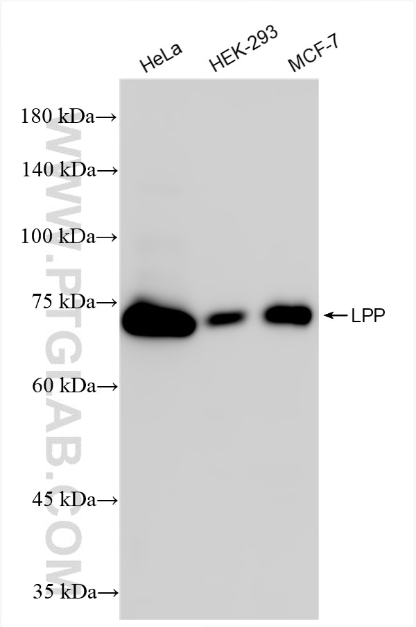 Western Blot (WB) analysis of various lysates using LPP Recombinant antibody (86117-3-RR)