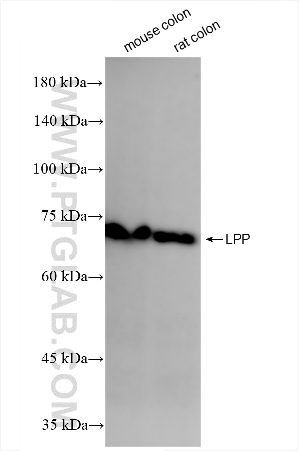 LPP