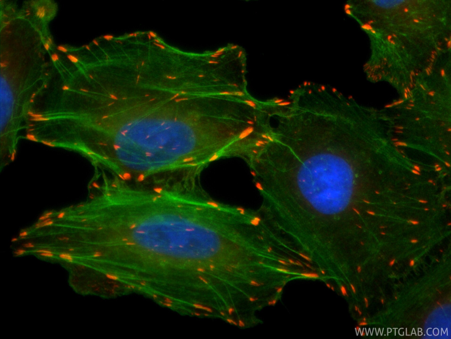 Immunofluorescence (IF) / fluorescent staining of A549 cells using CoraLite®594-conjugated LPP Recombinant monoclonal (CL594-86117-3)