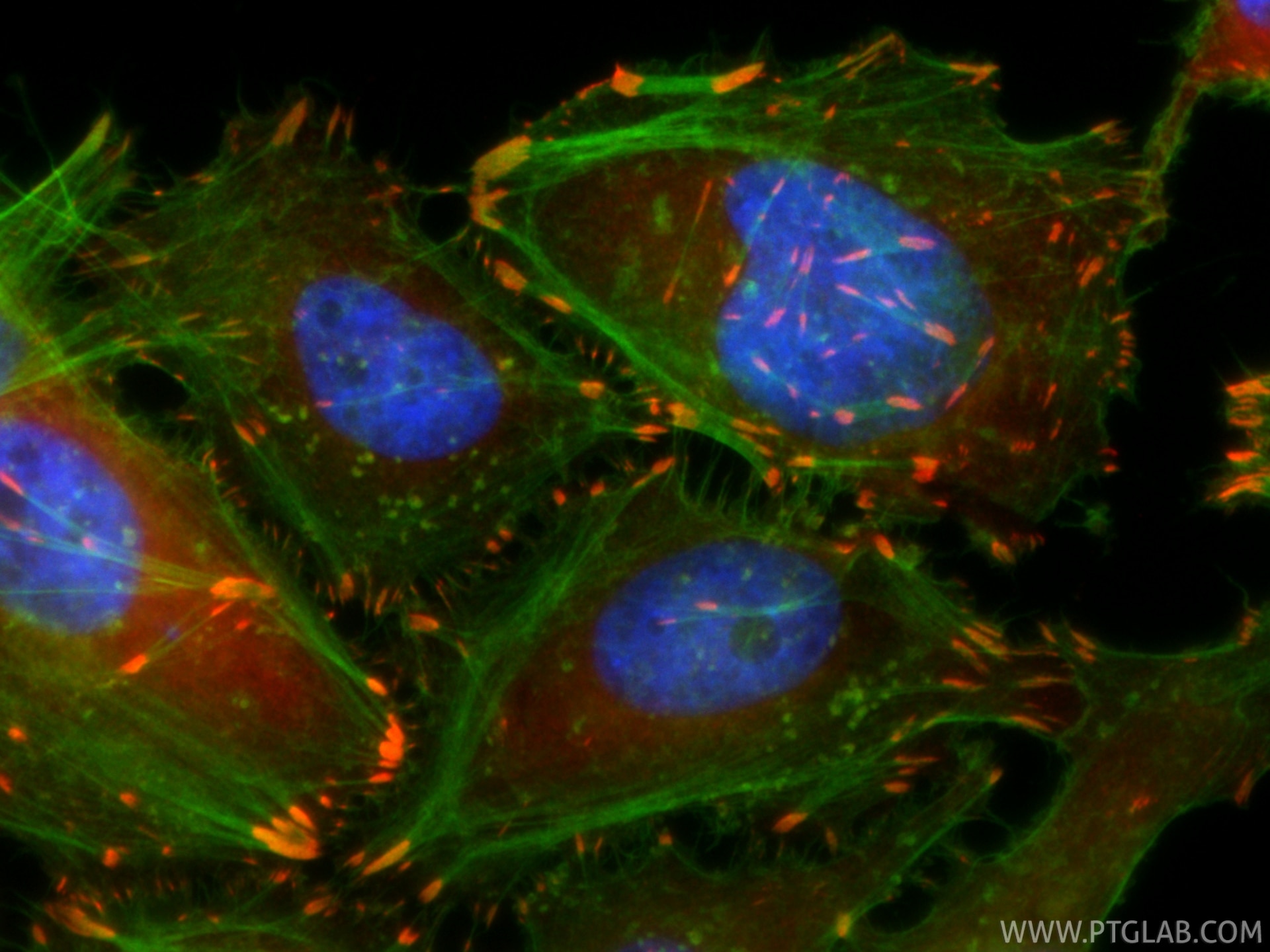 Immunofluorescence (IF) / fluorescent staining of HeLa cells using CoraLite®594-conjugated LPP Recombinant monoclonal (CL594-86117-3)