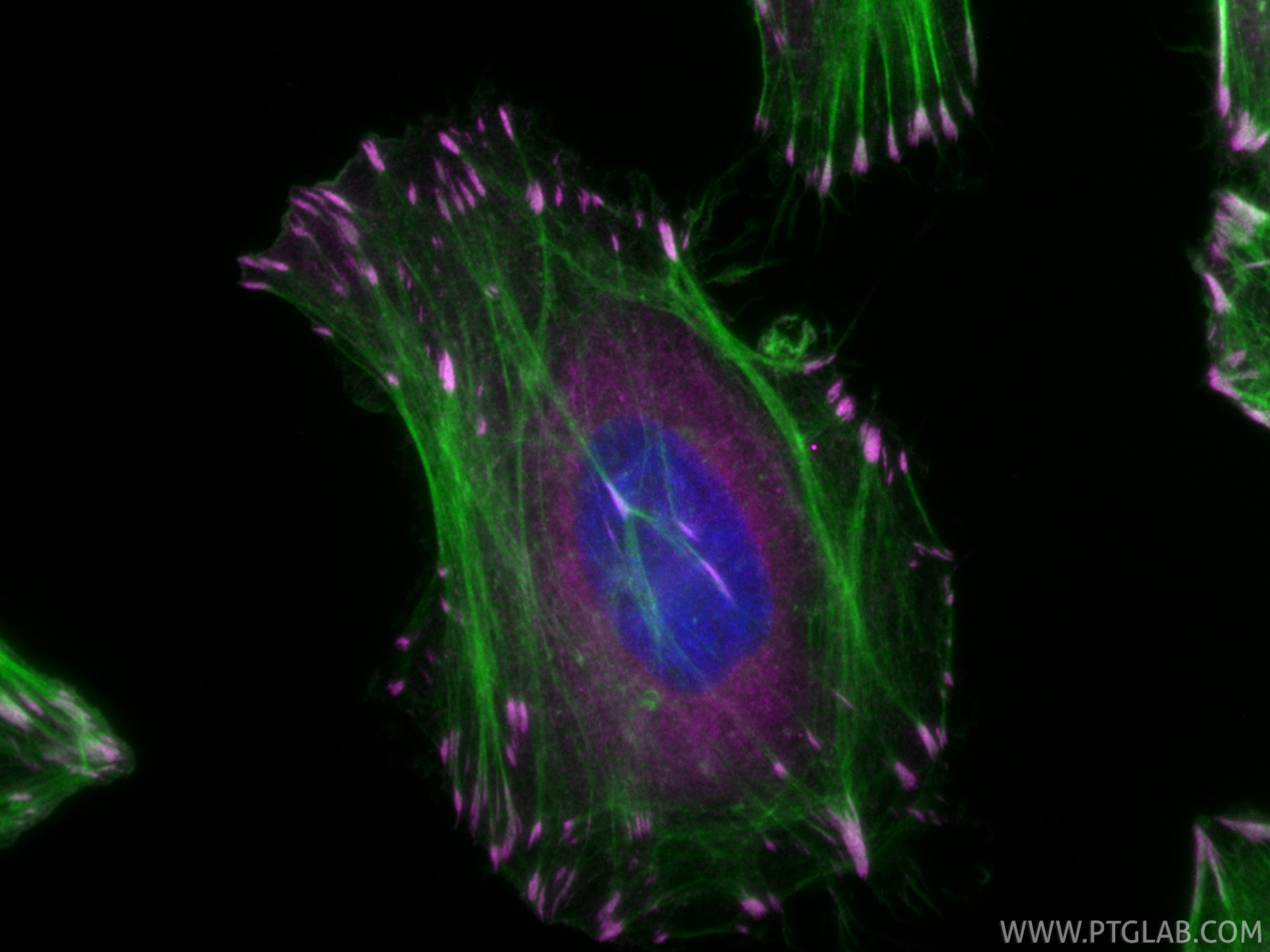 Immunofluorescence (IF) / fluorescent staining of HeLa cells using CoraLite® Plus 647-conjugated LPP Recombinant mono (CL647-86117-3)