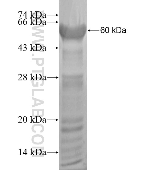 LPP fusion protein Ag19911 SDS-PAGE