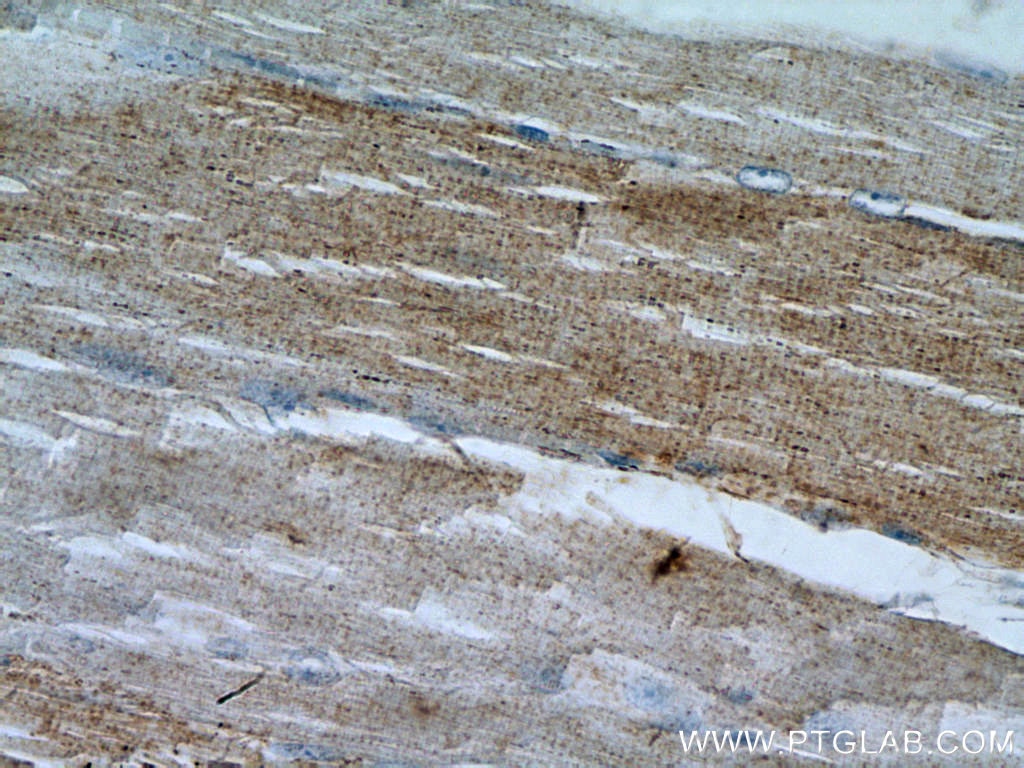 Immunohistochemistry (IHC) staining of human skeletal muscle tissue using LPPR2 Polyclonal antibody (25732-1-AP)