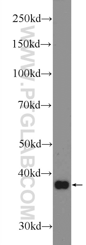 Western Blot (WB) analysis of HeLa cells using LPPR2 Polyclonal antibody (25732-1-AP)