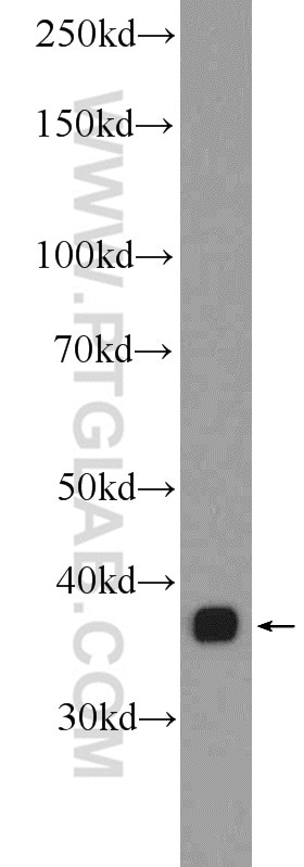 Western Blot (WB) analysis of 3T3-L1 cells using LPPR2 Polyclonal antibody (25732-1-AP)