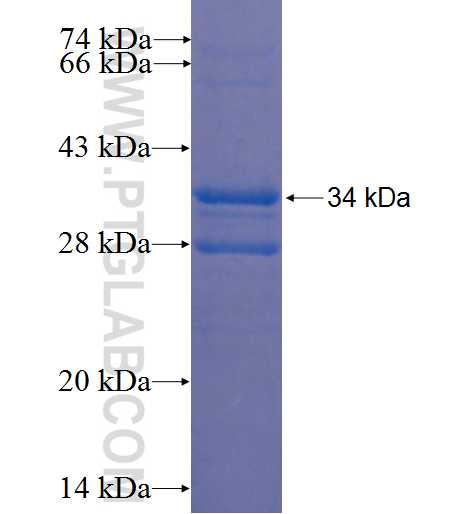 LPPR2 fusion protein Ag22839 SDS-PAGE