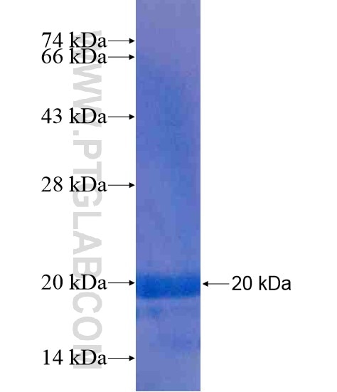 LPPR4 fusion protein Ag20401 SDS-PAGE