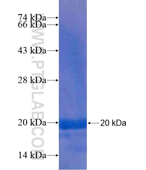 LPPR4 fusion protein Ag20401 SDS-PAGE