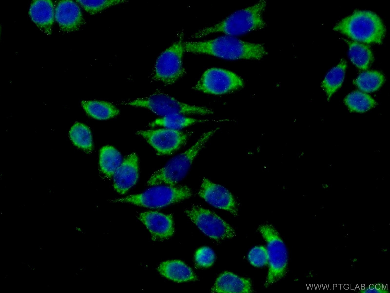 Immunofluorescence (IF) / fluorescent staining of PC-3 cells using LPXN Polyclonal antibody (11307-1-AP)