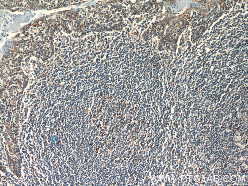 Immunohistochemistry (IHC) staining of human tonsillitis tissue using LPXN Polyclonal antibody (11307-1-AP)