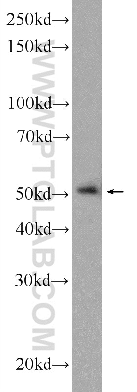 Western Blot (WB) analysis of PC-3 cells using LPXN Polyclonal antibody (11307-1-AP)