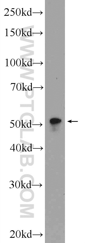 Western Blot (WB) analysis of RAW 264.7 cells using LPXN Polyclonal antibody (11307-1-AP)