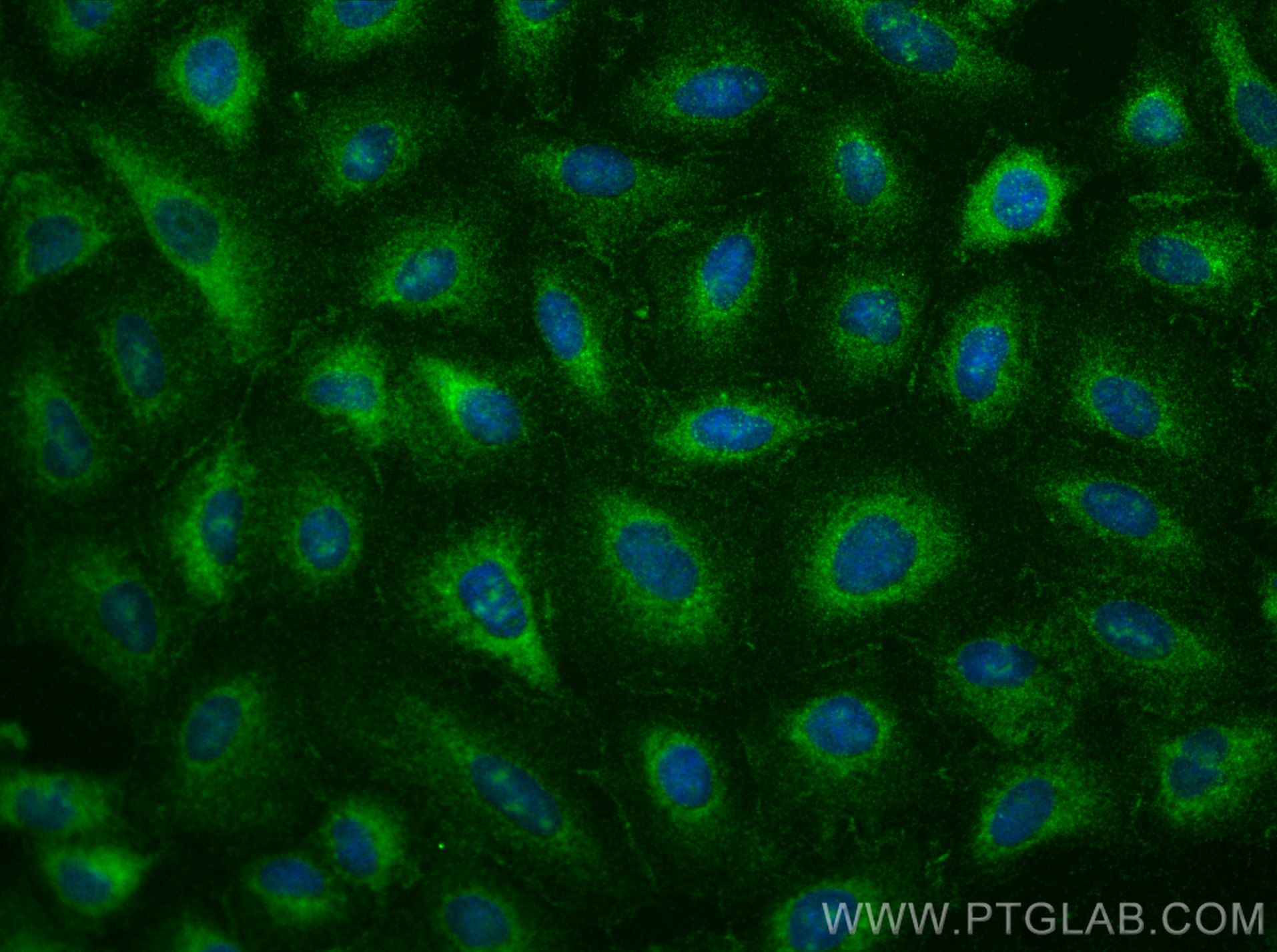 Immunofluorescence (IF) / fluorescent staining of A549 cells using LPXN Polyclonal antibody (31231-1-AP)