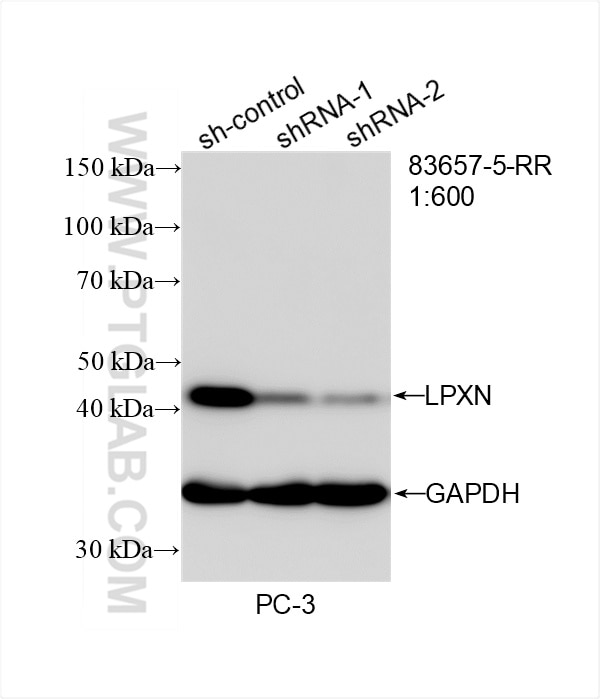Western Blot (WB) analysis of PC-3 cells using LPXN Recombinant antibody (83657-5-RR)