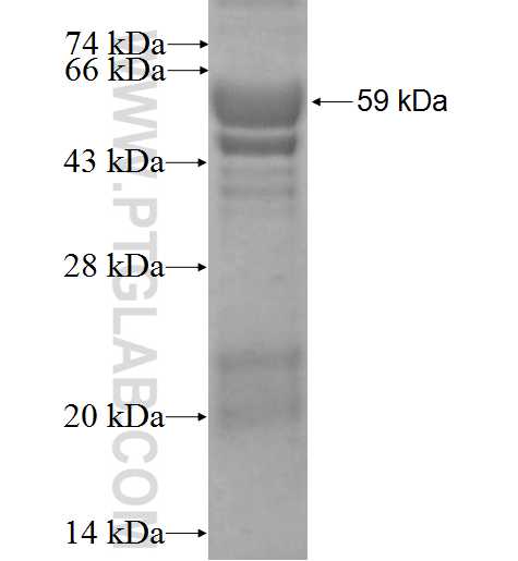 LPXN fusion protein Ag1845 SDS-PAGE