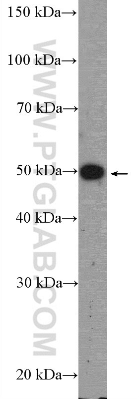 Western Blot (WB) analysis of mouse testis tissue using LRAT Polyclonal antibody (12815-1-AP)