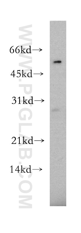 WB analysis of mouse testis using 12815-1-AP